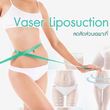 Vaser Liposelection (เวเซอร์ ไลโป) or Body Tite
