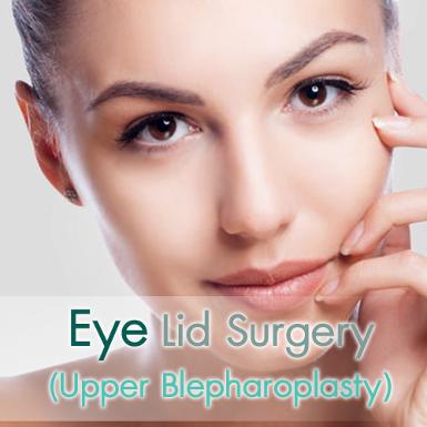 Eye Lid Surgery (Upper Blepharoplasty) 