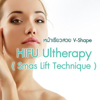 HIFU Ultherapy (Smas Lift Technique)