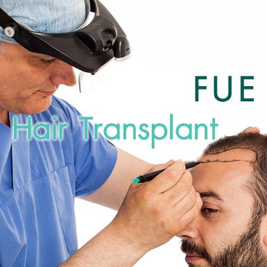 ปลูกผม Hair Transplant FUE